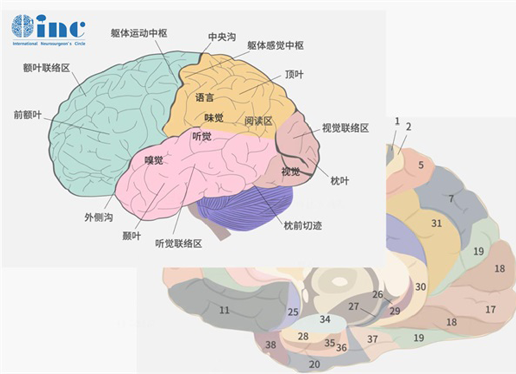 什么是功能区脑胶质瘤？解读功能区定位较新观点及手术策略