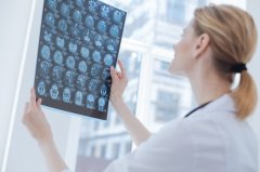 <b>脑瘤治疗新方法：纳米技术辅助治疗胶质母细胞瘤</b>