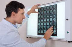脑肿瘤会引起头疼吗？