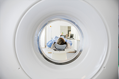 放射性脑损伤的 ＭＲＩ 研究进展