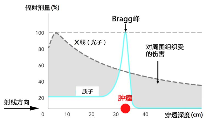 质子治疗脑肿瘤