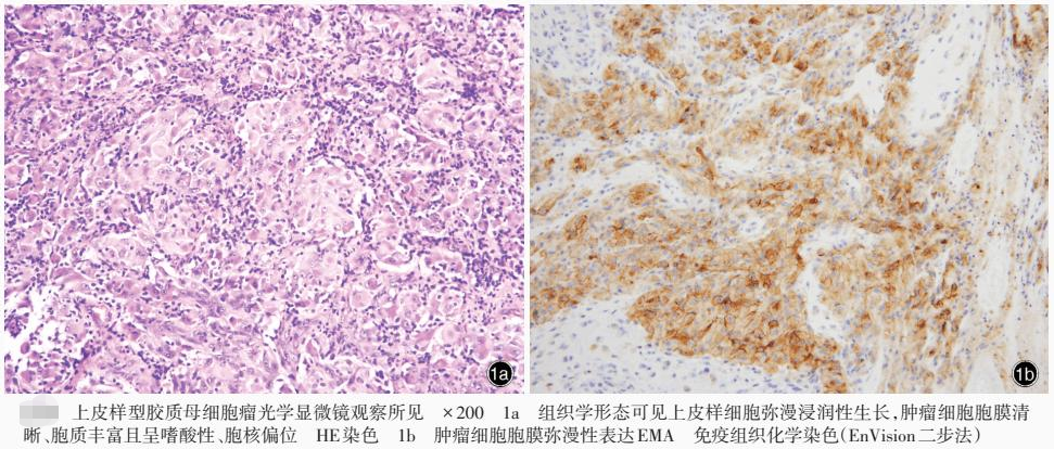 确诊 吗 是 negative 必学的新冠疫情英语单词和常见对话_sore