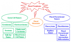儿童松果体区肿瘤治疗