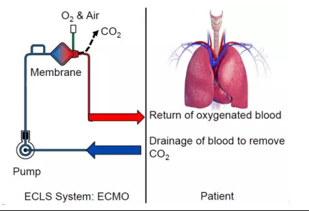 一线生机、永不放弃，心跳骤停后ECMO“硬核”技术屡创生命奇迹