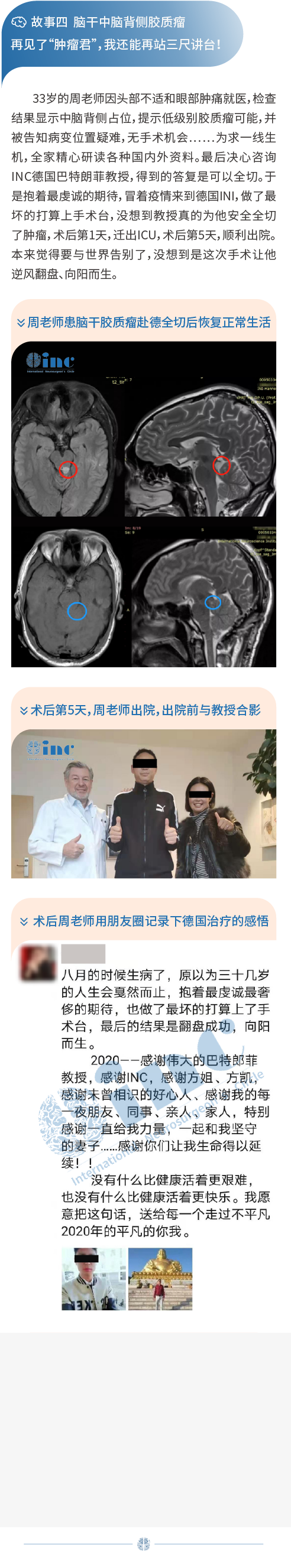 脑干中脑胶质瘤