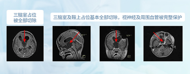 德国<a href='/guojizhuanjia/Bertalanffy.html' target='_blank'><u>巴特朗菲</u></a>教授