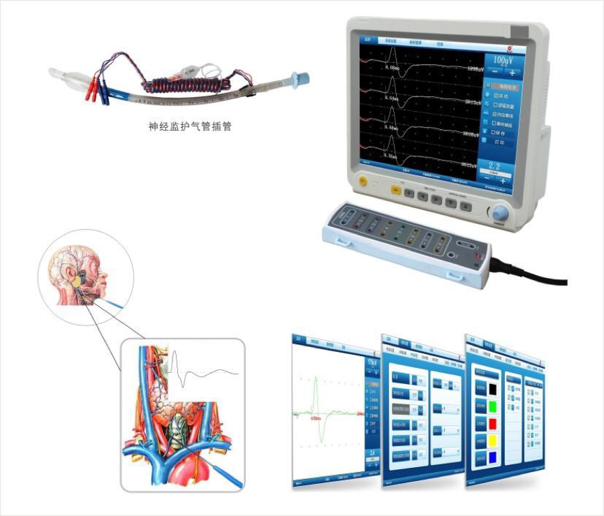 神经电生理监测设备
