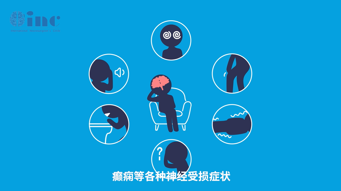 高级别胶质瘤早期症状有哪些？50%以上患者存在头痛！