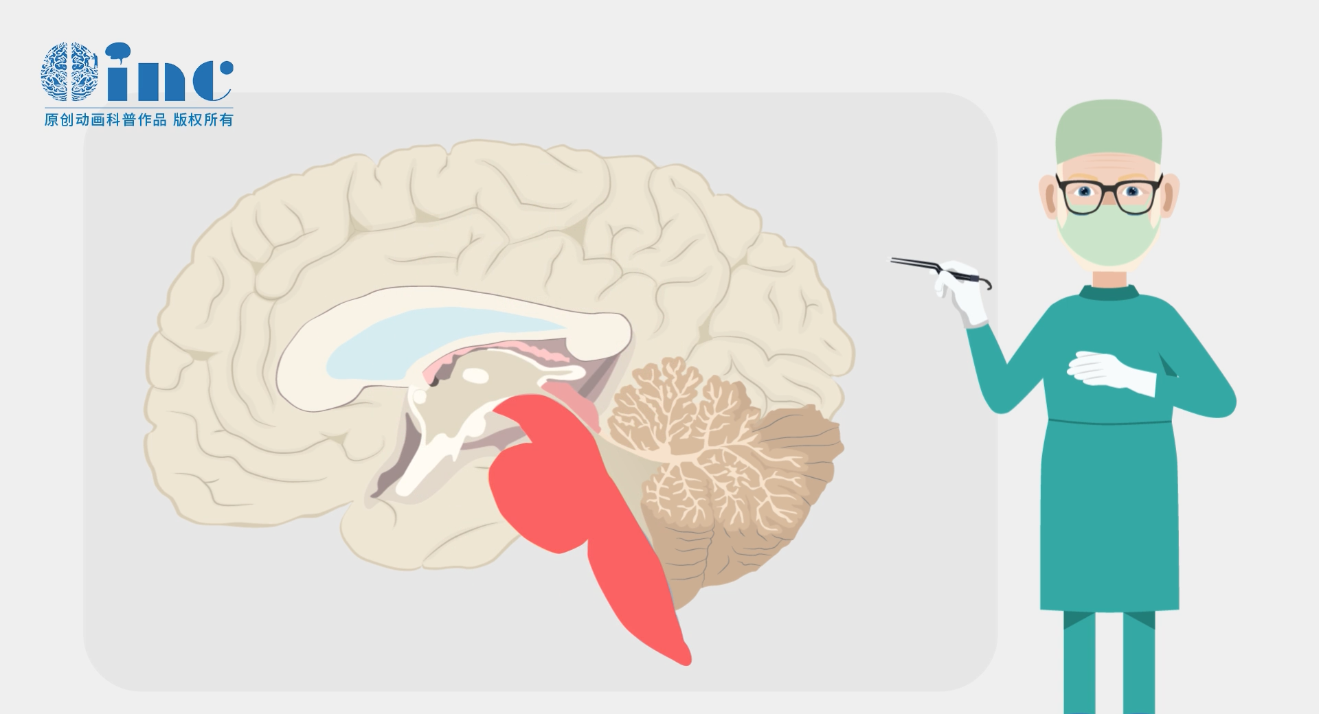 成人脑干胶质瘤生存期怎么样？得了脑干胶质瘤能活多久？