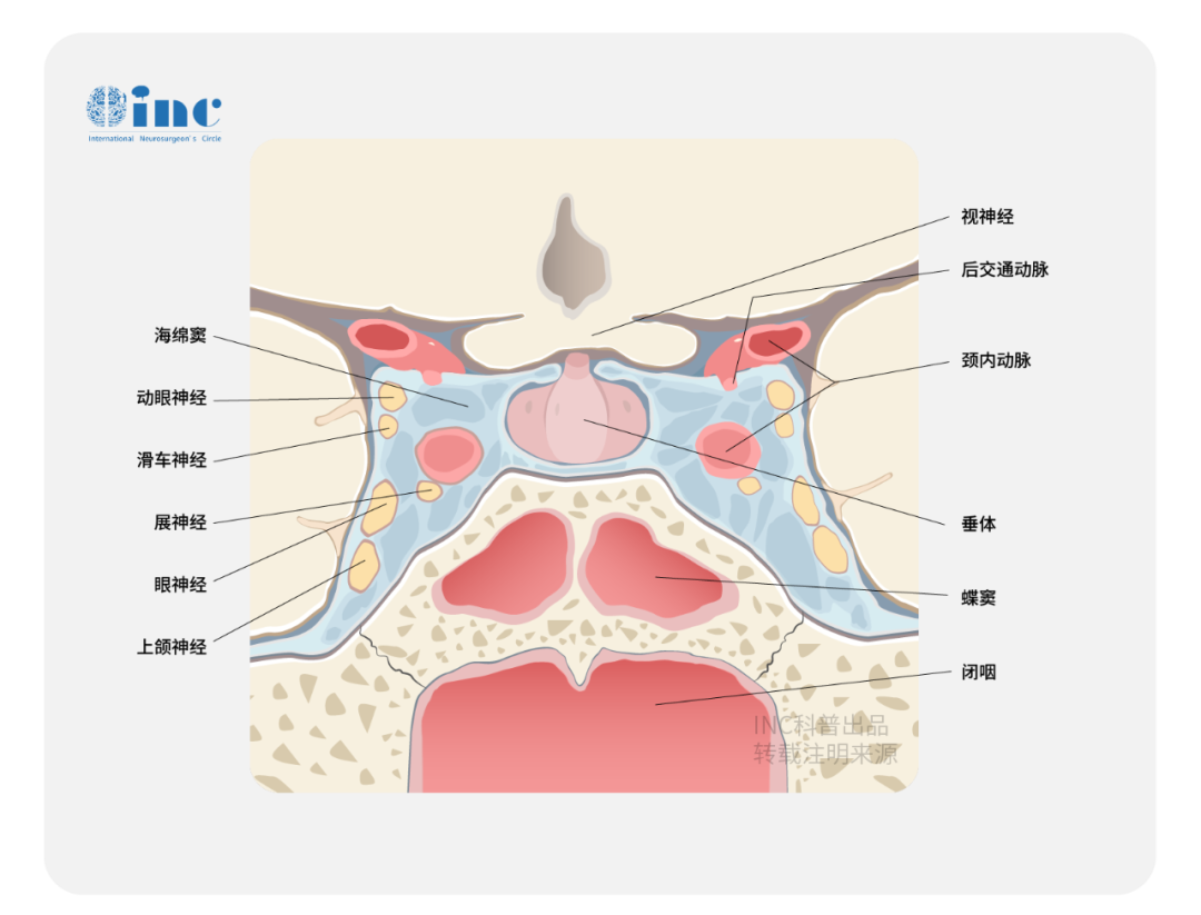 视路胶质瘤严重吗？视路胶质瘤