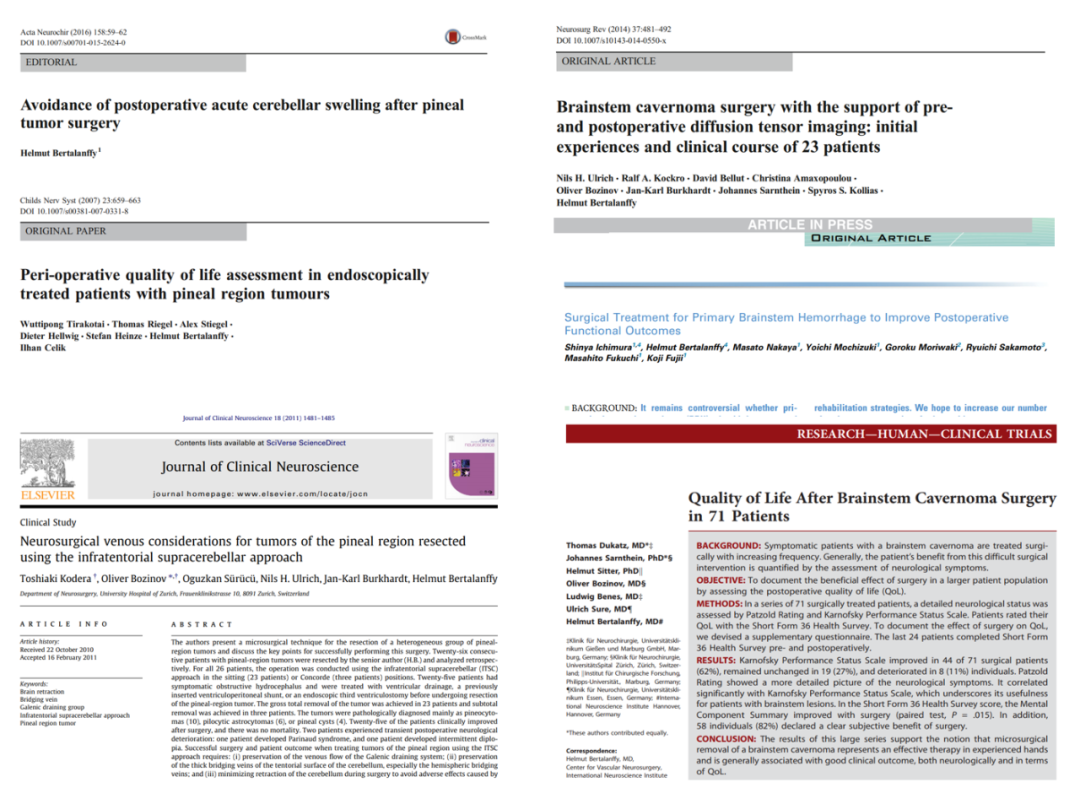松果体区肿瘤手术论文