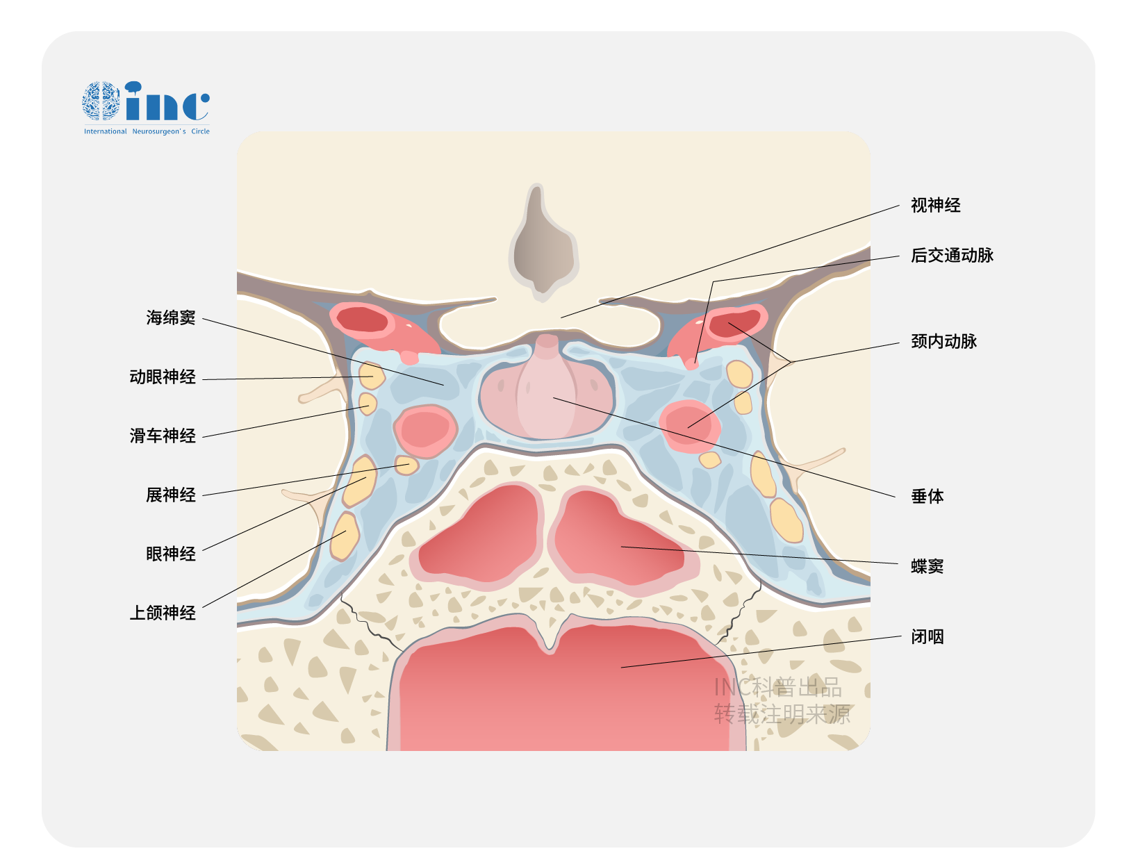 视神经鞘脑膜瘤是什么病？症状有哪些？