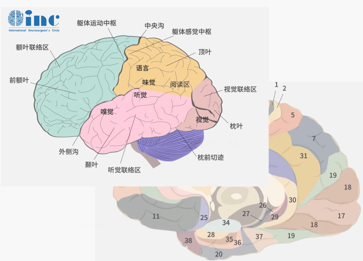 神经节细胞瘤