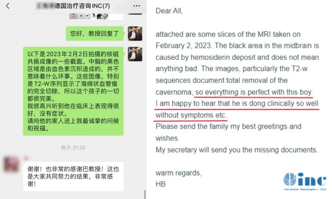 7岁男孩脑干海绵状血管瘤，赴德术后2年随访