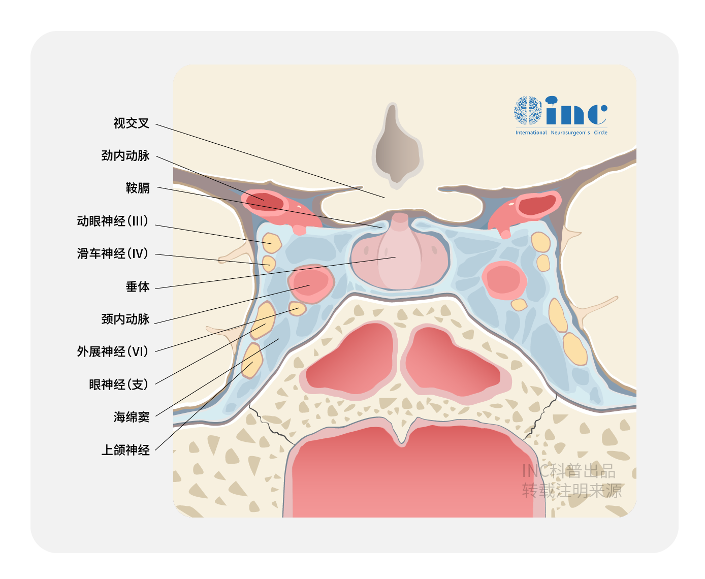 累及眼眶的海绵窦脑膜瘤如何治疗？有手术机会吗？