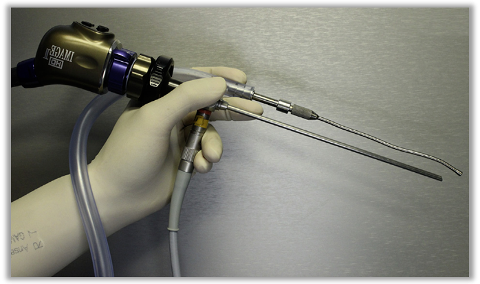 神经外科内镜是什么？神经外科“筷子技术”是什么？