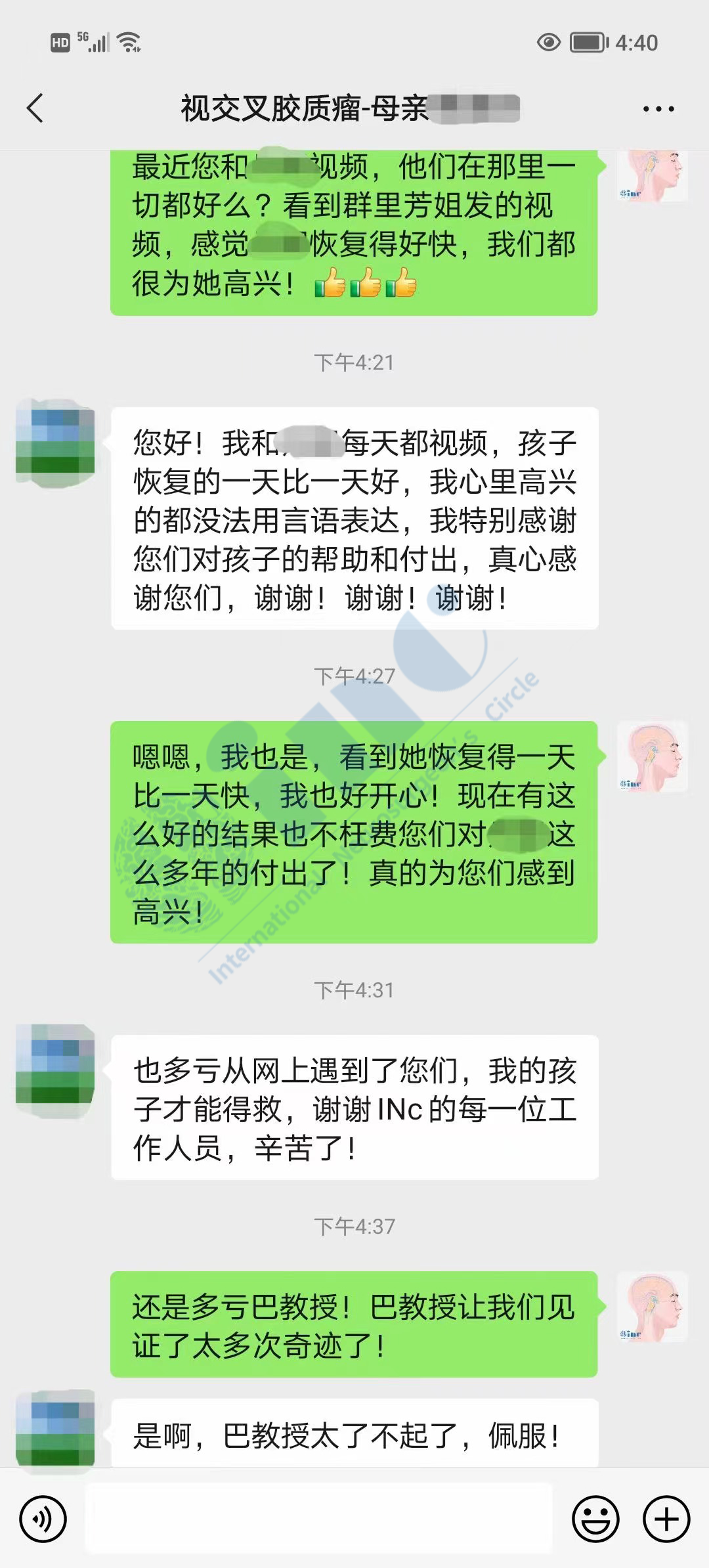 孩子视力下降居然是视神经胶质