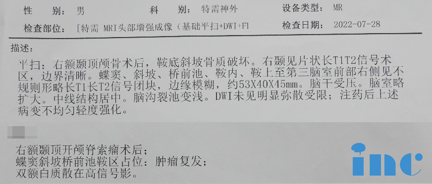 In July 2022,Mr.Su's vision related symptoms worsened again for the third time.An MRI scan revealed another recurence of his chordoma.