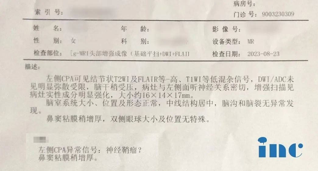 听神经瘤真的没法顺利全切吗