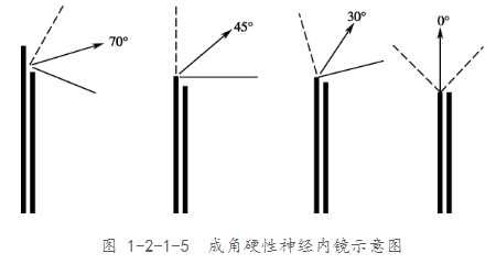 单鼻孔神经内镜手术