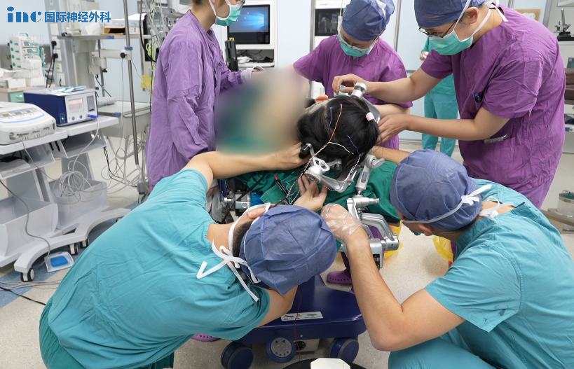 术中神经电生理医生在放置头皮电较