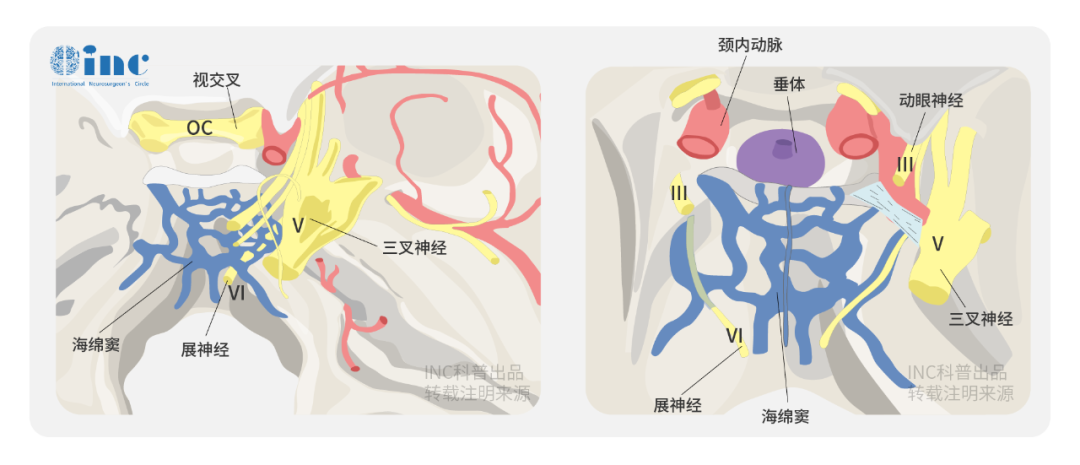 【国际脊索瘤手术大咖案例】联