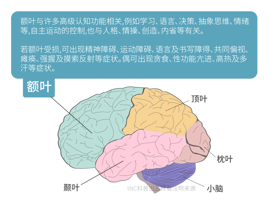 胶质瘤真实案例