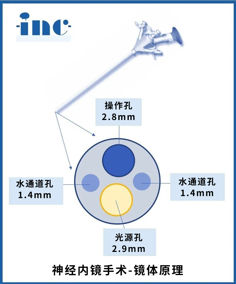 【神经内镜科普系列一】为何它不见刀口、却能切大瘤？“十八般”手术设备知多少？