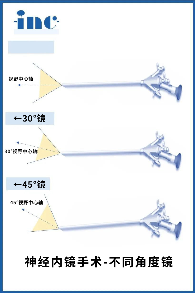 拥有不同角度的硬镜