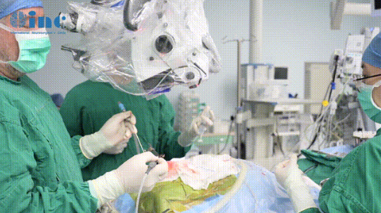 巴教授成功为欧阳女士手术，安全全切脑干海绵状血管瘤。