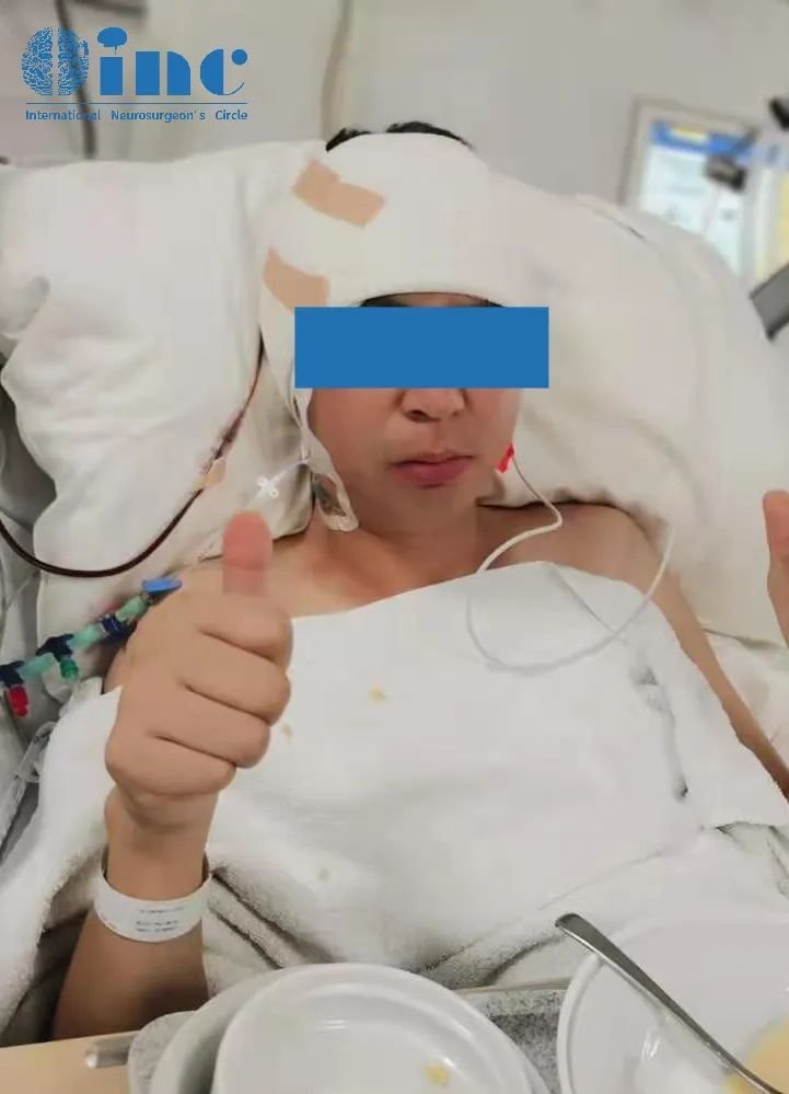 术后1天迁出ICU，回到普通病房，苏醒，如常
