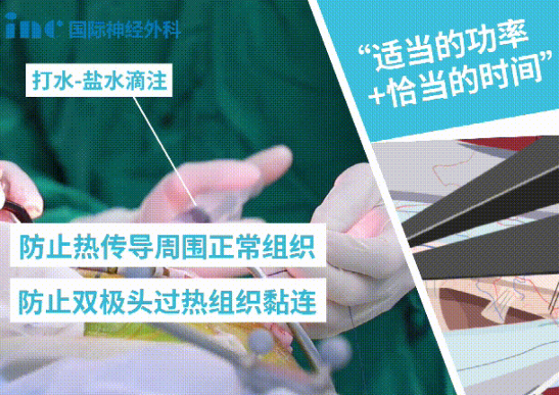 双较电凝是如何达到止血效果呢？