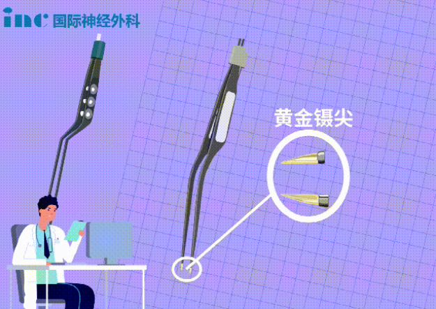 双较电凝是黄金镊尖？