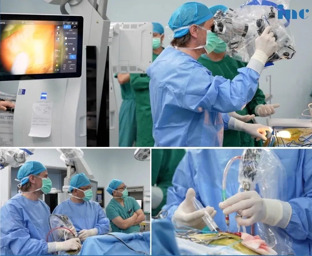 世界神外内镜+显微镜“双镜联合”手术大咖  　　拥有世界上最大的脊索瘤患者群