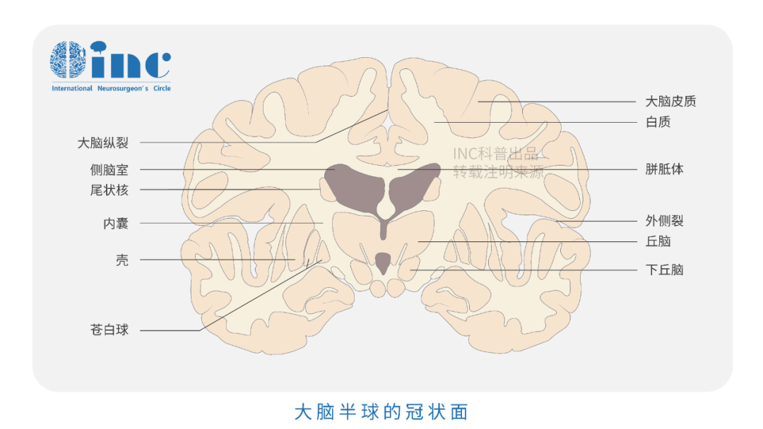 功能区海绵状血管瘤案例