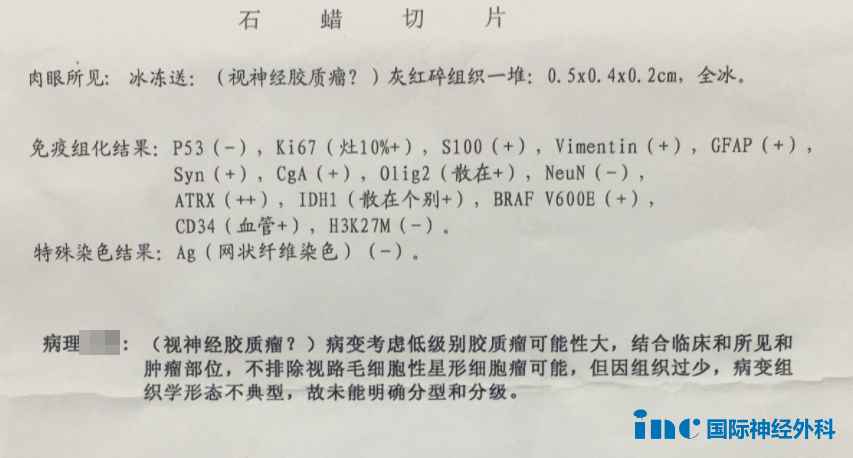 变胖可能不只是嘴馋、爱喝水可