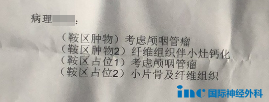 巴教授示范手术显示病理结果