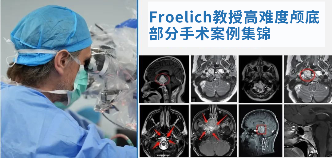 INC法国福洛里希教授  　　部分精彩案例交流