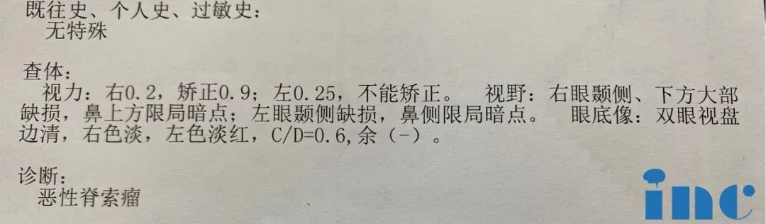 开颅手术