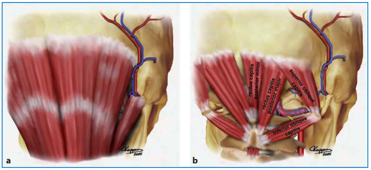 图：颅颈背侧区域浅层肌肉层（a）和深部肌肉层（b）的图示