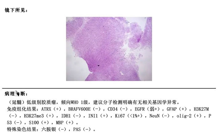 病理结果