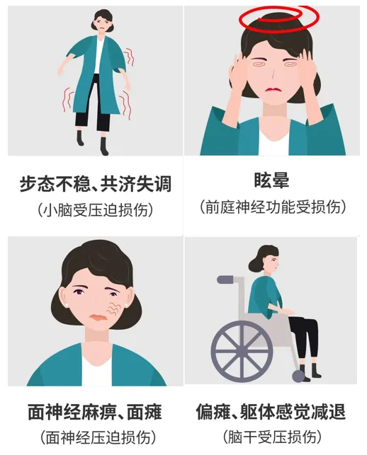 桥臂胶质瘤真实案例：桥臂在脑干上吗？解读手术失败有哪些风险？