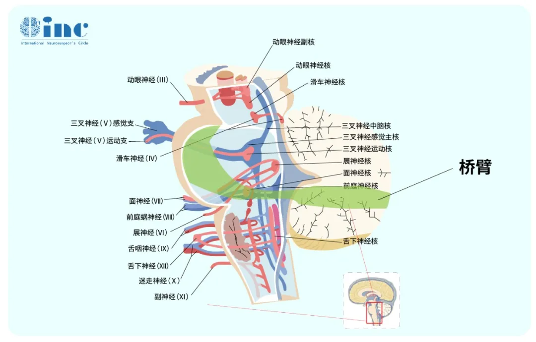 桥臂图片