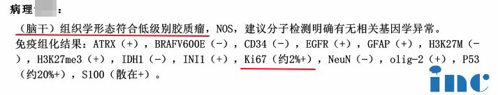 脑干-桥臂胶质瘤术后一个月检查图片