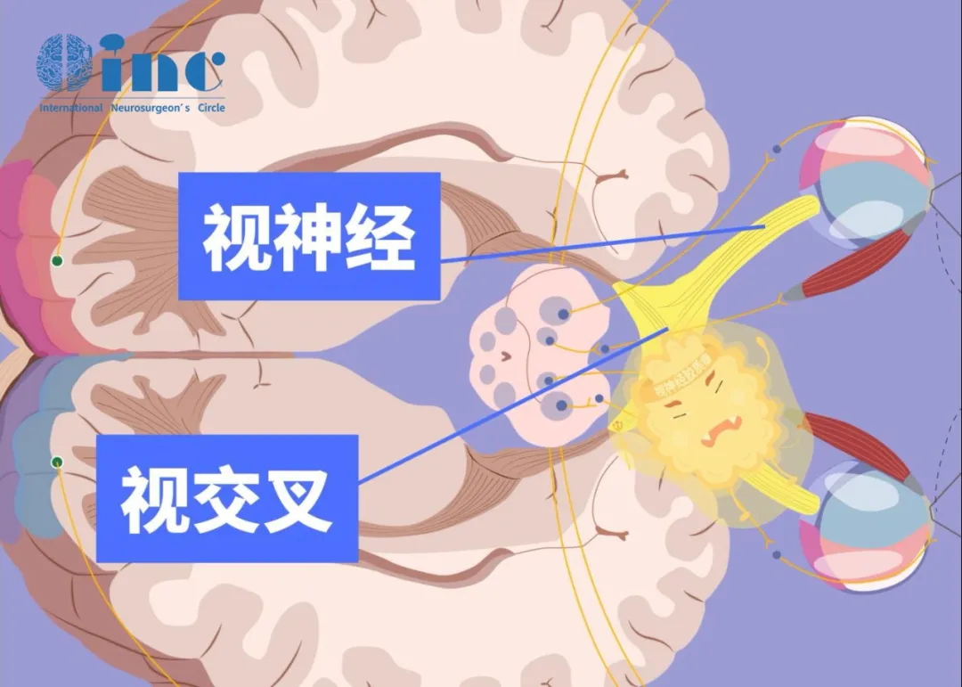 视神经、视交叉图片