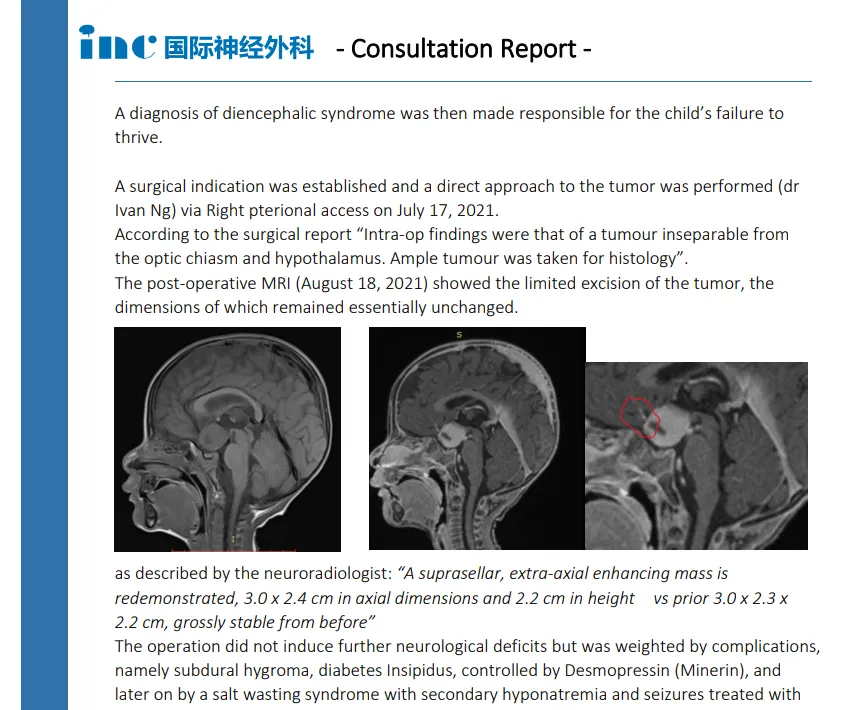 视神经胶质瘤患者5个问题，他却写了3000字“论文级”回复