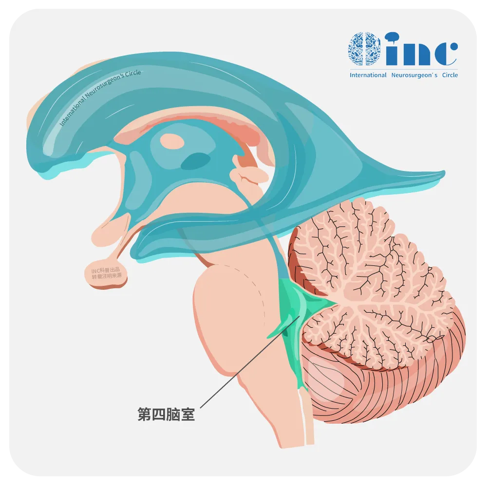 第四脑室图片