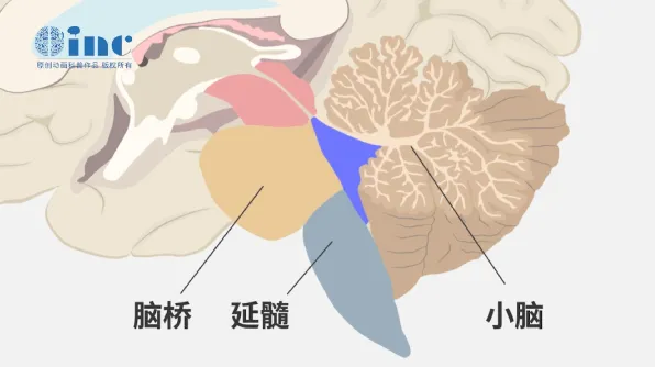 四脑室图片