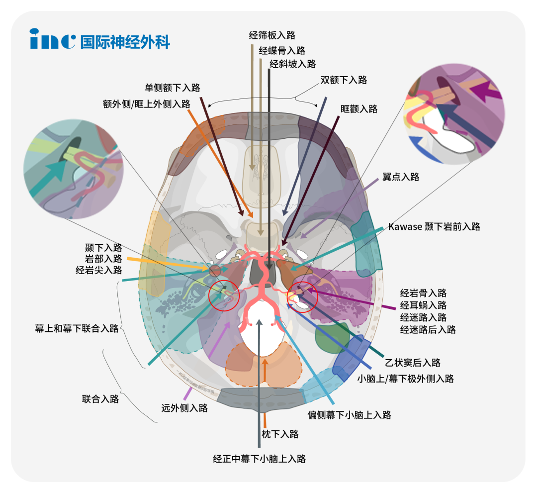 颈静脉孔区