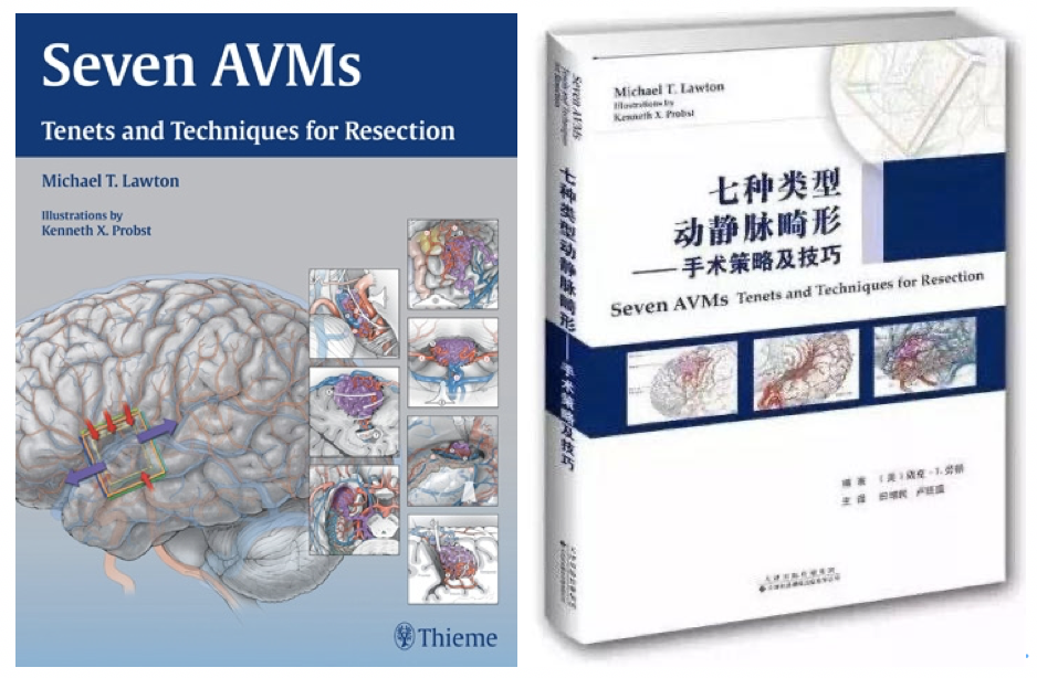 图Lawton教授动静脉畸形手术技巧专著及中文翻译版本